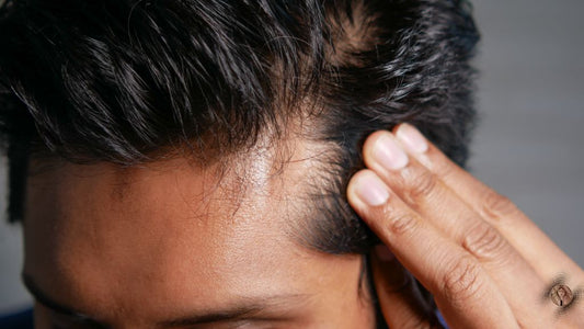 cuidar el pelo graso